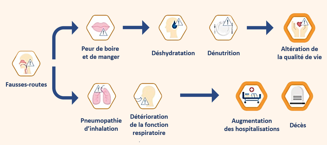 infographie-dysphagie-prevenir-le-risque-de-fausse-route